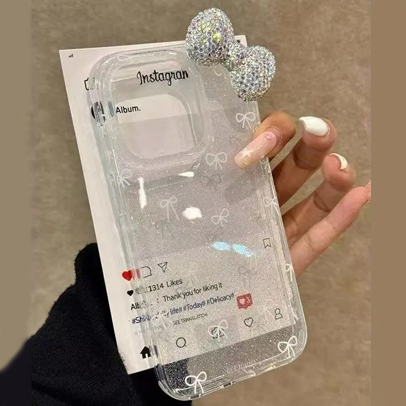 Coque de téléphone de luxe ave - Phone Cases Best avis et prix
